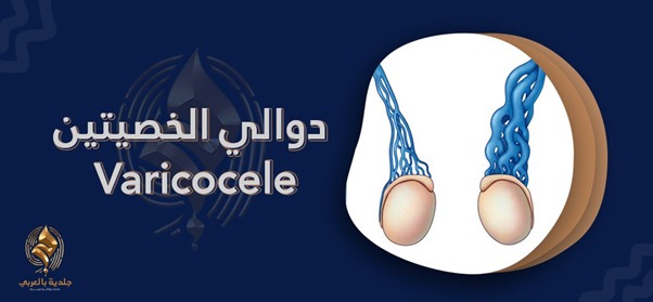 دوالى الخصيتين| تعرف إلى العدو الخفي لصحة الرجل الجنسية
