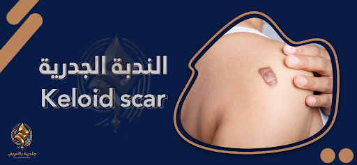 أكثر من مجرد علامة: اكتشف أسباب ندوب الجدرة وأساليب علاجها