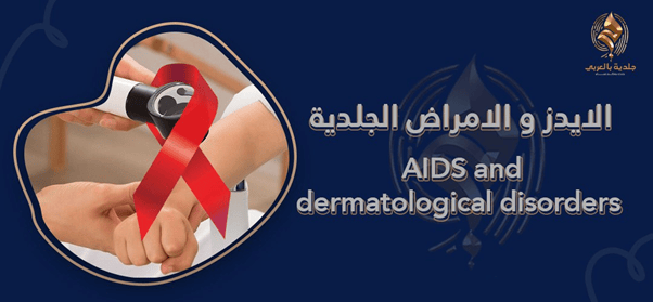كيف يتغير جلد مريض الإيدز؟ … إليك أشهر اعراض الايدز على الجلد