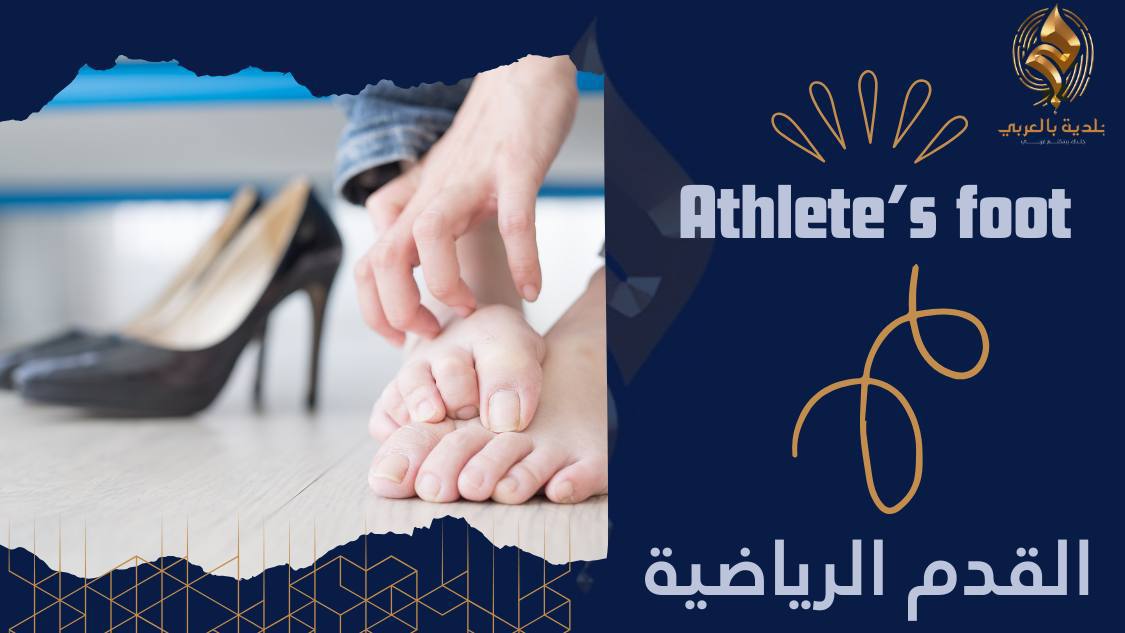كيفية علاج تينيا القدم | وما هي طرق الوقاية؟