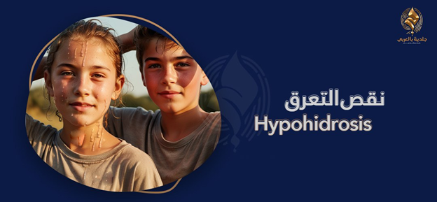 ما هي اسباب عدم التعرق (anhidrosis)؟ وهل هو نعمة أم نقمة؟
