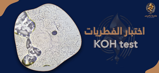 اختبار الفطريات KOH test تشخيص سريع وفعال للعدوى الفطرية