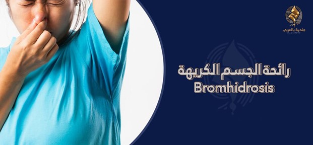 تعرف على اسباب رائحة العرق الكريهه، أعراضها وكيفية علاجها