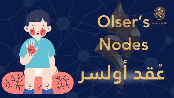 عقد اوسلر | هل تحاول أجسامنا أن توصل لنا رسائل من خلالها؟