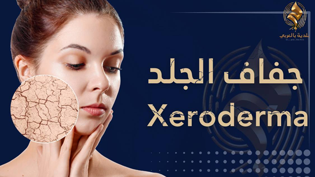 جفاف الجلد I نصائح لعلاج جفاف الجلد والحكة