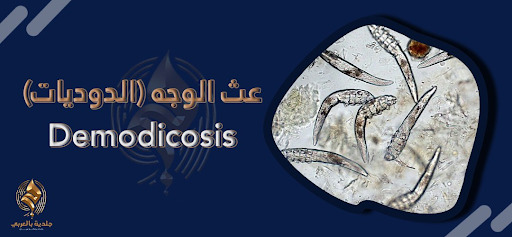 رحلة إلى أعماق البشرة| اكتشف أسرار عالم عث الوجه الدويديات Demodicosis