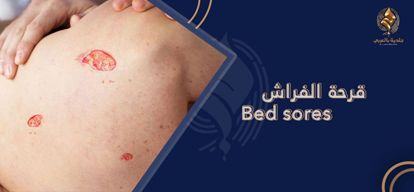 هل قرحة الفراش تُصيب كبار السن فقط؟ وكيفية علاج قرحة الفراش؟