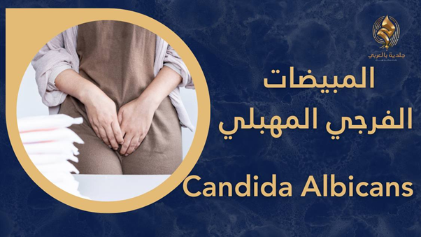 ما أعراض داء المبيضات المهبلي؟ وما أسبابه؟