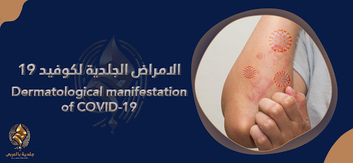 هل تستدعي الأعراض الجلدية لمرض كوفيد المستجد نوعا من القلق؟
