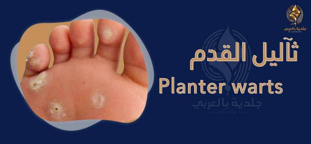 اكتشف شكل عين السمكة في القدم وطرق علاجها