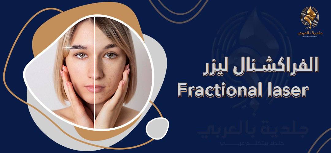 كل ما تحتاج معرفته عن مراحل الفراكشنال ليزر ونتائجه