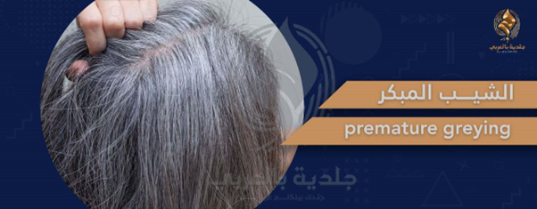 تعرف على سبب ظهور الشعر الأبيض في سن العشرين؟