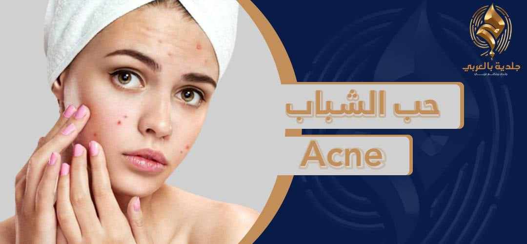 ماذا تعرف عن أخطر أنواع حب الشباب؟ أسبابها؟ وما هي خطورتها؟ وكيفية علاجها؟